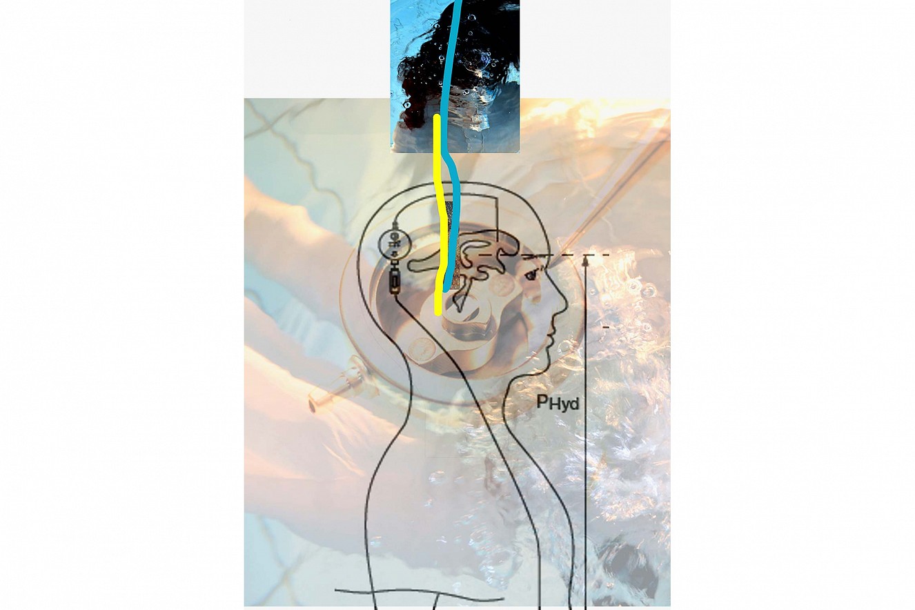 Entwurf Kopfmodell 
Aufnahmen aus der Produktion/Ventile der Neurochirurgie, Firma Miethke GmbH, Potsdam